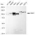 KD-Validated KSR1 Rabbit mAb (20 μl)