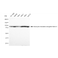 KD-Validated EEF2 Rabbit mAb (20 μl)
