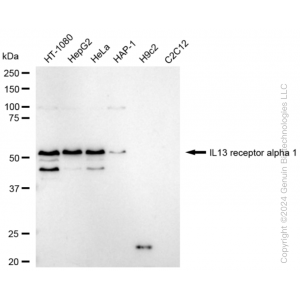KD-Validated IL13RA1 Rabbit mAb (20 μl)