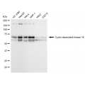 KD-Validated CDK16 Rabbit mAb (20 μl)