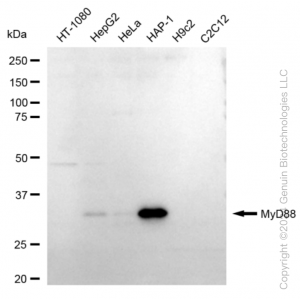 KD-Validated MYD88 Rabbit mAb (20 μl)