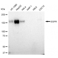 KD-Validated EGFR Rabbit mAb (20 μl)