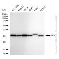 KD-Validated NQO1 Rabbit mAb (20 μl)