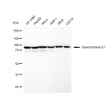 KD-Validated GLB1 Rabbit mAb (20 μl)