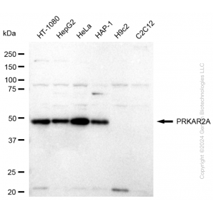 KD-Validated PRKAR2A Rabbit mAb (20 μl)