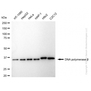 KD-Validated POLB Rabbit mAb (20 μl)