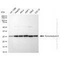 KD-Validated PRDX4 Rabbit mAb (20 μl)