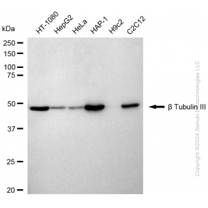 KD-Validated TUBB3 Rabbit mAb (20 μl)