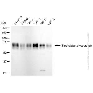 KD-Validated TPBG Rabbit mAb (20 μl)