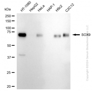 KD-Validated SOX9 Rabbit mAb (20 μl)