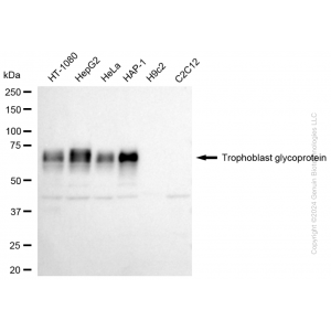 KD-Validated TPBG Rabbit mAb (20 μl)