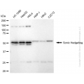 KD-Validated SHH Rabbit mAb (20 μl)