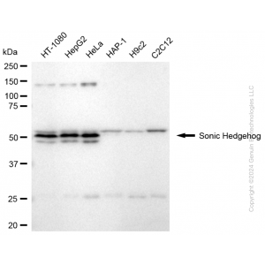 KD-Validated SHH Rabbit mAb (20 μl)