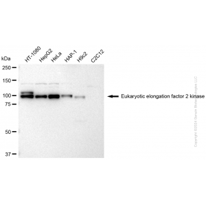 KD-Validated EEF2K Rabbit pAb (20 μl)