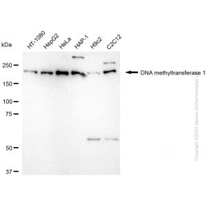 KD-Validated DNMT1 Rabbit mAb (20 μl)
