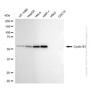 KD-Validated CCNB1 Rabbit mAb (20 μl)