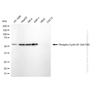 KD-Validated Phospho-CCNB1 (Ser126) Rabbit mAb (20 μl)
