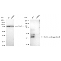 KD-Validated GATA3 Rabbit mAb (20 μl)