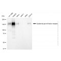 KD-Validated EGFR Rabbit mAb (20 μl)