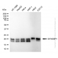 KD-Validated EIF4EBP1 Rabbit mAb (20 μl)