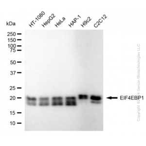 KD-Validated EIF4EBP1 Rabbit mAb (20 μl)