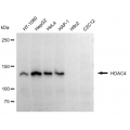 KD-Validated HDAC4 Rabbit mAb (20 μl)