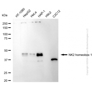 KD-Validated NKX2-1 Rabbit mAb (20 μl)