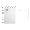 KD-Validated ERBB2 Mouse mAb (20 μl)