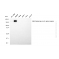 KD-Validated EGFR Mouse mAb (20 μl)