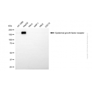 KD-Validated EGFR Mouse mAb (20 μl)