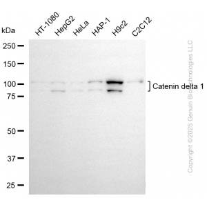 KD-Validated CTNND1 Mouse mAb (20 μl)