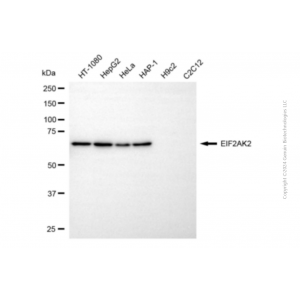 KD-Validated EIF2AK2 Mouse mAb (20 μl)