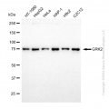 KD-Validated GRK2 Rabbit mAb (20 μl)