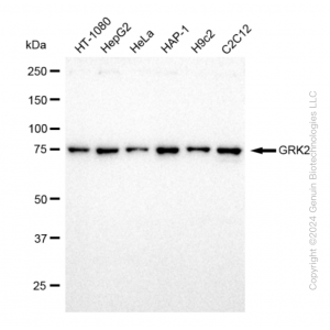 KD-Validated GRK2 Rabbit mAb (20 μl)