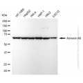 KD-Validated ANXA6 Rabbit mAb (20 μl)