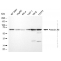 KD-Validated ANXA6 Rabbit mAb (20 μl)