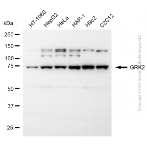 KD-Validated GRK2 Rabbit pAb (20 μl)