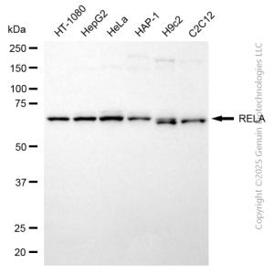 KD-Validated RELA Rabbit pAb (20 μl)