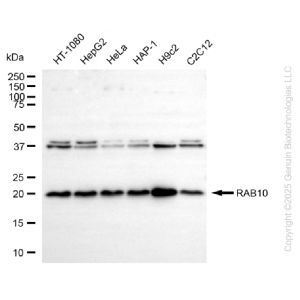 KD-Validated RAB10 Rabbit mAb (20 μl)