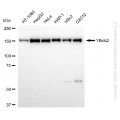 KD-Validated YTHDC2 Rabbit mAb (20 μl)