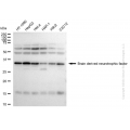 KD-Validated BDNF Rabbit mAb (20 μl)