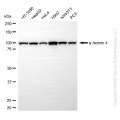 KO Validated ACTN4 Rabbit mAb (20 μl)
