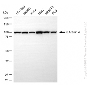KO Validated ACTN4 Rabbit mAb (20 μl)