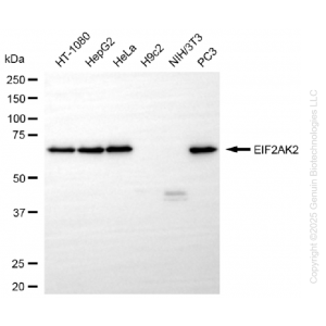 KO-Validated EIF2AK2 Rabbit mAb (20 μl)