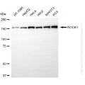 KO-Validated ROCK1 Rabbit mAb (20 μl)