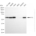 KO-Validated FTO Rabbit mAb (20 μl)