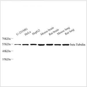 Anti-beta Tubulin Rabbit pAb (100 μl)