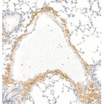 Anti-Collagen I Rabbit pAb (100 μl)