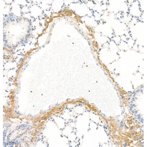 Anti-Collagen I Rabbit pAb (100 μl)