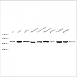 Anti-VEGFA Rabbit pAb (100 μl)
